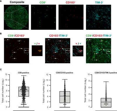 Tumor infiltrating CD8/CD103/TIM-3-expressing lymphocytes in epithelial ovarian cancer co-express CXCL13 and associate with improved survival